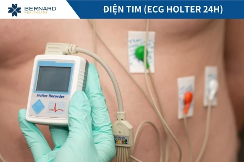 Điện tim (ECG Holter 24h)